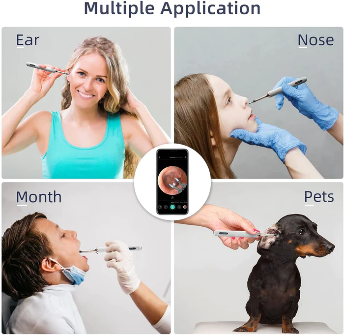 BeBird Ear Cleaner with Camera : Model Note 3 pro - Image 5