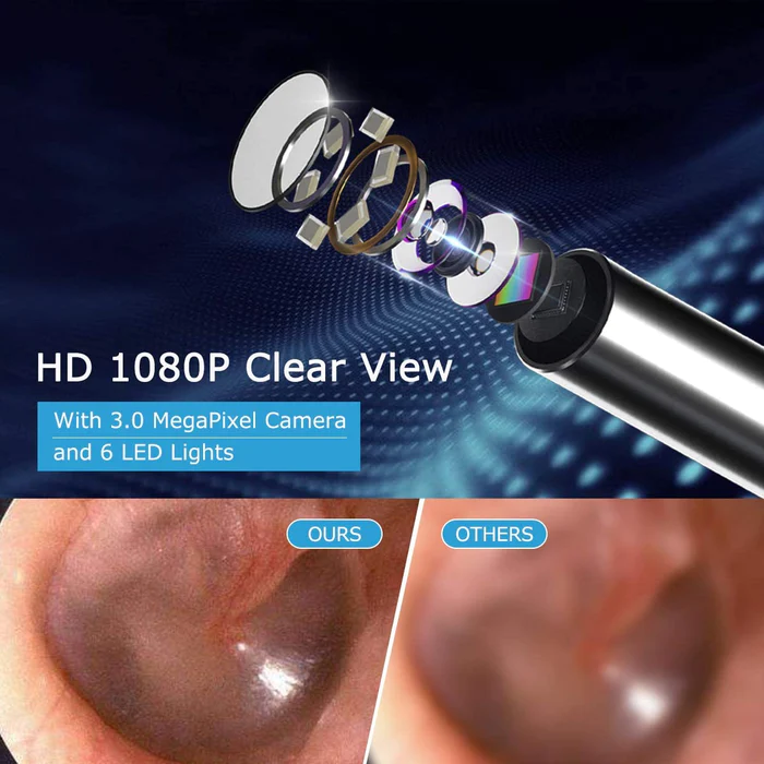 BeBird wireless ear cleaning rod with camera: Model R1 - Image 4